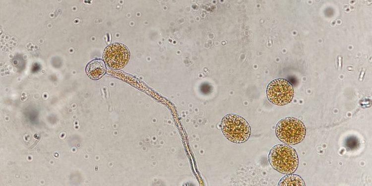 trigo ferrugem amarela